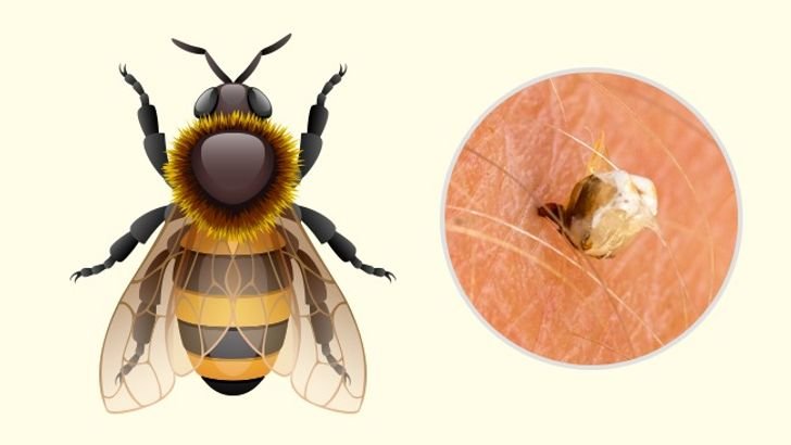10 Bug Bites Anyone Should Be Able to Identify