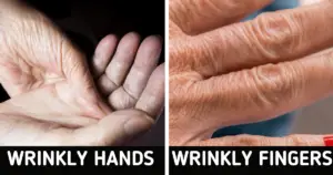 Wrinkled hands
